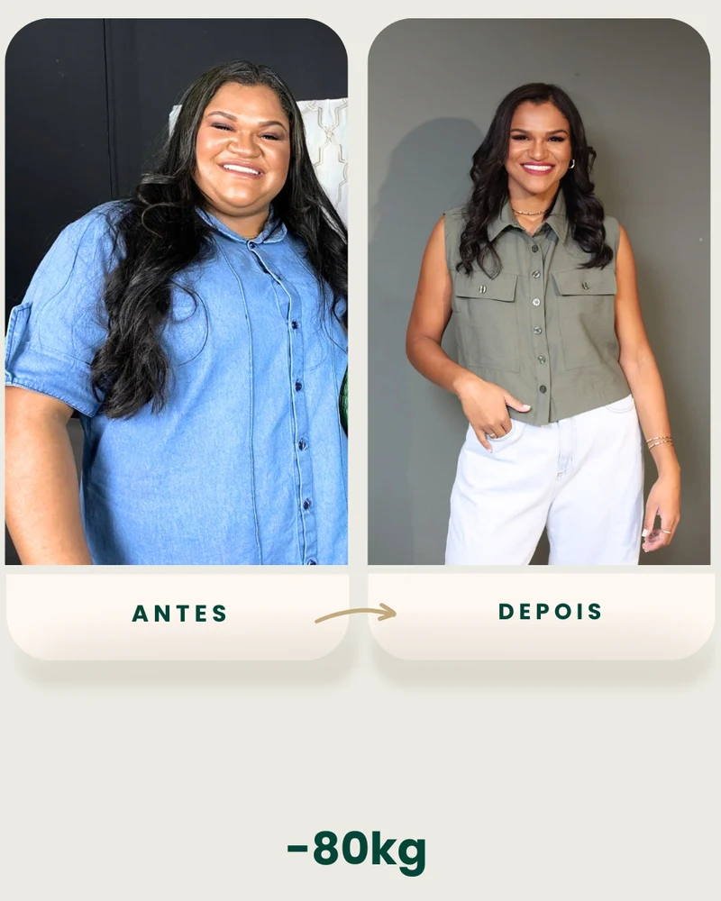 Resultado de emagrecimento — antes e depois (1 de 6)