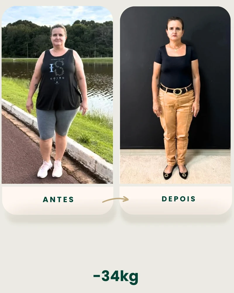 Resultado de emagrecimento — antes e depois (4 de 6)