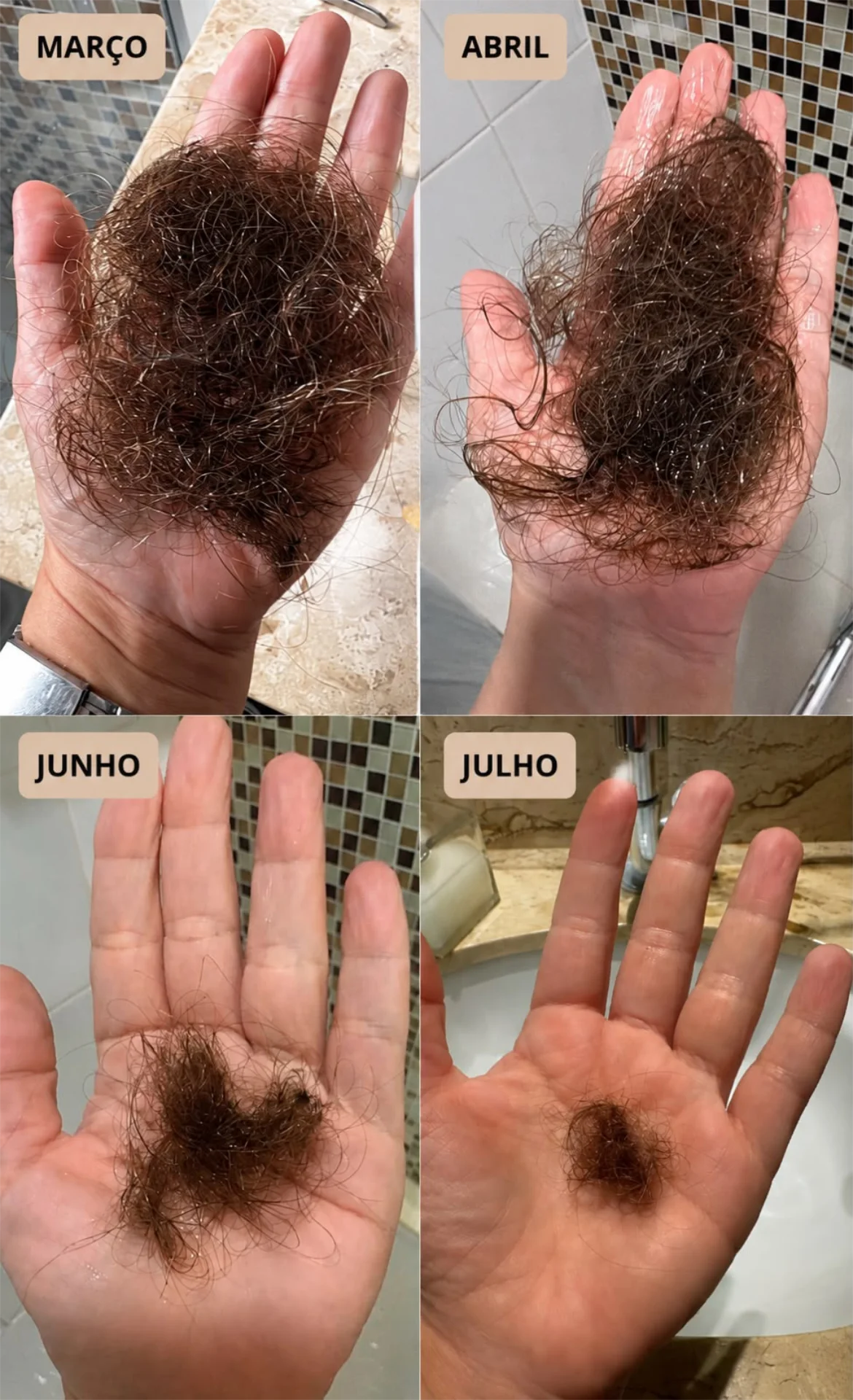 Queda de cabelo na mão diminuindo mês a mês, de março a julho